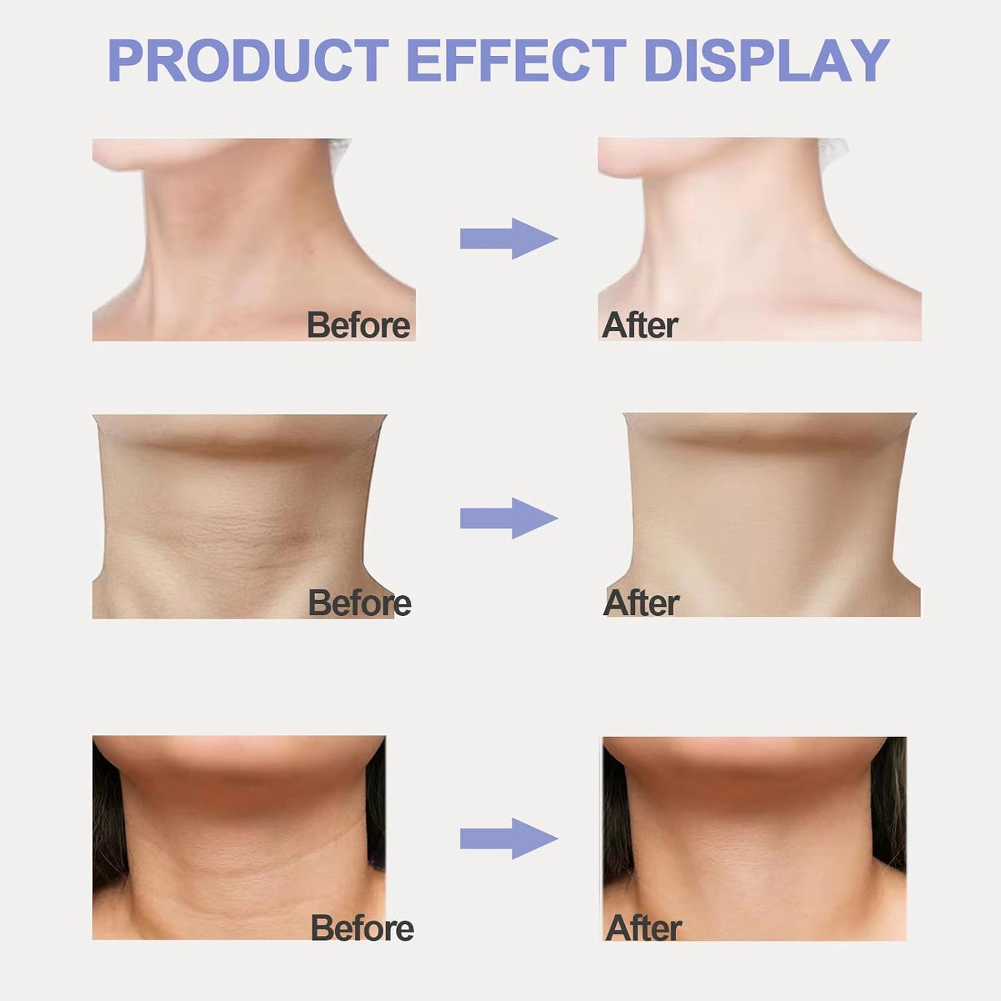 Neck Tightening Cream